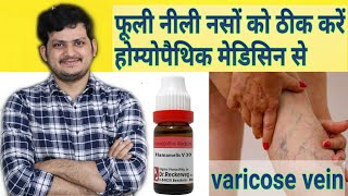 Powerful Homeopathic Medicine for Varicose veins [upl. by Marty707]