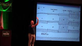 Understanding Ventricular Tachycardia [upl. by Daffodil]