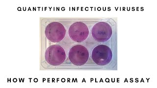 How to Perform a Plaque Assay [upl. by Eelirrem]