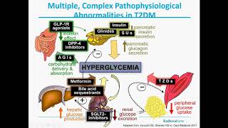 College Antidiabetica Module D [upl. by Zetroc674]