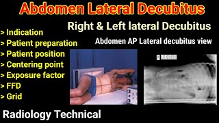 Abdomen Lateral Decubitus  Right amp Left lateral decubitus view Abdomen radiography Part 3 [upl. by Anircam]