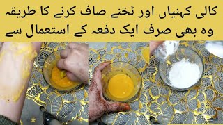 Kali Koni ko Saaf krne ka Tarika Dark Elbow And Knee Clean at home [upl. by Iarahs]