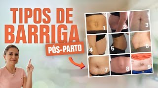 5 Tipos de Barriga PósParto Conheça Todos os Tipos de Barriga e O Que Fazer Para Voltar ao Normal [upl. by Nerhtak]