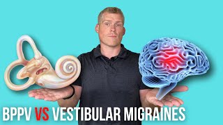 BPPV Vertigo VS Vestibular Migraine [upl. by Apgar]