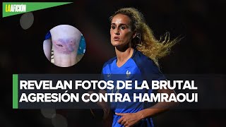 Kheira Hamraoui muestra las lesiones de su violenta agresión [upl. by Eteragram]