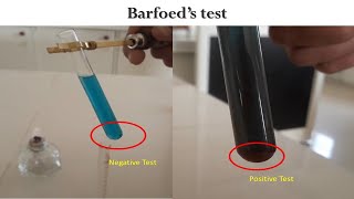 Barfoeds Test [upl. by Arac]