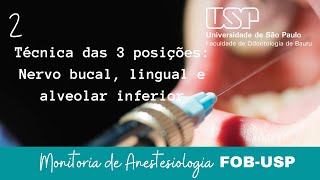 Técnica das 3 Posições  Anestesia dos Nervos Bucal Lingual e Alveolar Inferior  Monitoria FOBUSP [upl. by Rist305]