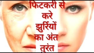 Fitkari फिटकरी से करे झुर्रिया को अंत तुरंत Fitkari ke fayde Alum [upl. by Carmelia]