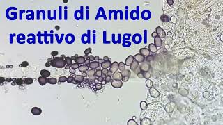 Amido e reattivo di Lugol  reazione dei granuli osservata al microscopio 🔬 [upl. by Carlen]