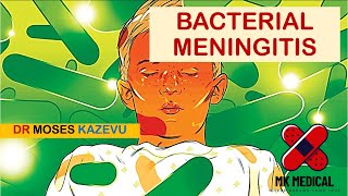 Bacterial Meningitis [upl. by Aneertak174]