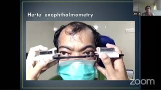 PG Orientation  Exophthalmometry  Dr Ann J K [upl. by Lorelie]