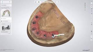 3Shape Dental System  Full Anatomy Zirconia Bridge on Implants with Gums [upl. by Herrera]