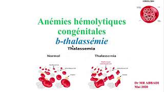 Anémies hémolytique congénitales B thalassémie  cours dhématologie 4ème année medecine [upl. by Attenauqa]