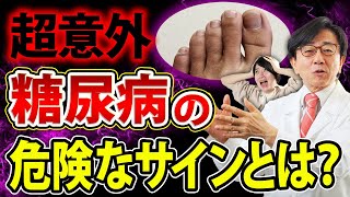 【放置厳禁】知らないと後悔する糖尿病の初期症状はコレ！絶対見逃さないで！ [upl. by Birkner]