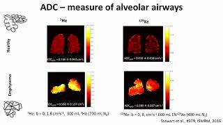 ISMRM MR Academy  Methods and Applications of Hyperpolarized 129Xe [upl. by Quirita]