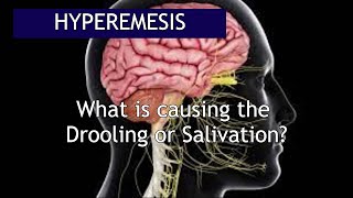 Hyperemesis What causes the Excessive Salivation  Antai Hospital [upl. by Assilak777]