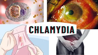 Chlamydia infection  causes symptoms complications amp diagnosis [upl. by Adnawyek]