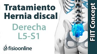 Tratamiento de la hernia discal L5 y S1 derecha o quinta lumbar y sacro [upl. by Grinnell858]