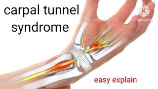 carpal tunnel syndromesymptomstestexercisetreatment in Hindi how treat carpal tunnel syndrome [upl. by Nyret]