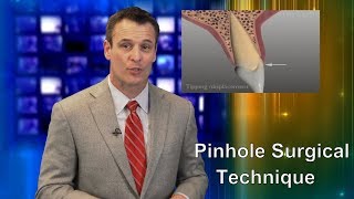 Pinhole Surgical Technique for Gum Recession Dr Nemeth Explains 2018 [upl. by Nalim]