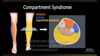 peripheral vascular disease  70 CVS mcqs [upl. by Aicyle]