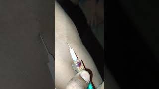 Iv injection kaise lagaye veine me injection kaise lagaye [upl. by Piks]