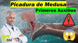 La Picadura de medusa 🦑🌊  🚨 Tratamiento Primeros auxilios [upl. by Sunev]