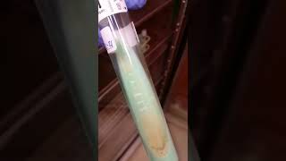 Mycobacterium tuberculosis TB on LJ agar  Microbiology [upl. by Seko214]