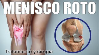 ROTURA de MENISCO 🦵🏼¿Cómo Saber Si Hay Una Lesión De Menisco 🦵🏼 Cirugía Terapia ⭐ Dr EDSON SERRANO [upl. by Eirak]