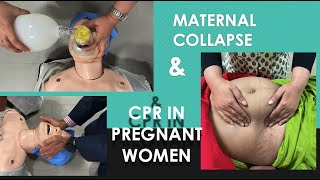 Maternal Collapse and CPR in Pregnant women Perimortem Caesarean section [upl. by Nehgaem]