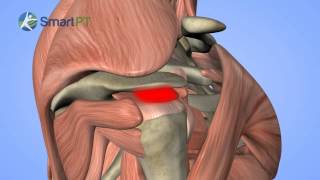 Shoulder Impingement [upl. by Alton267]