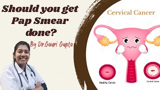 Should you get Pap Smear done [upl. by Trelu]