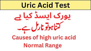 uric acid test uric acid kya hai causes of high uric acid [upl. by Charters]