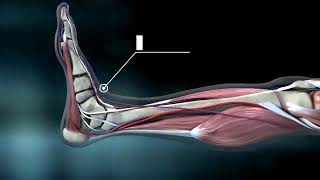 CMC 72 Assessing the Dorsalis Pedis Pulse [upl. by Thamora]