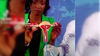 HOW A PAP SMEAR TEST IS DONE  Cervical Cancer  part 2 [upl. by Epolulot]