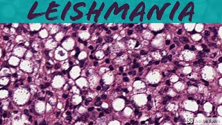 Leishmaniasis 5Minute Pathology Pearls [upl. by Adallard]