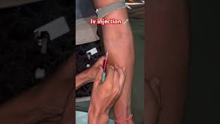 Iv injection viralvideo li [upl. by Birdie]