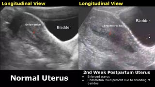 Gynecological amp Obstetric Ultrasound Normal Vs Abnormal Scan  Uterus Ovary Cervix Pregnancy USG [upl. by Alehtse]