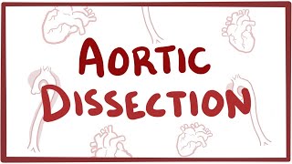 Aortic Dissection  causes symptoms diagnosis treatment pathology [upl. by Attenor]