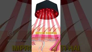 LED lights for hair Growth  Dr Sarin [upl. by Ruhl]