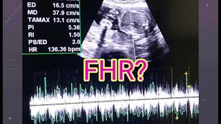 U Tell Me Baby Gender On Ultrasound 🙂  FHRV Cephalic or Breech  Placenta Posterior or Anterior [upl. by Ylrrad108]