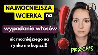 Przepis na najmocniejszą wcierkę na wypadanie włosów  Dlaczego domowa wcierka jest najlepsza [upl. by Abbi1]