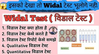 Widal Test Practical in hindi  Qualitative Widal Test  Quantitative Widal Test  Typhoid Test [upl. by Halyak]