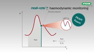 Mostcare UP  Haemodynamic monitoring [upl. by Aihsot866]