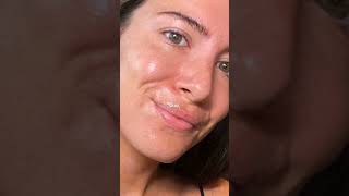 5 MUSTTRY PHARMACY FACE WASHES FOR ACNEPRONE SKIN acneexpert acnespottreatment youtubeshorts [upl. by Aisenat]