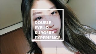 Nonincisional Double Eyelid Surgery Experience [upl. by Kcajyllib709]