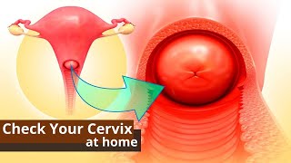 How You Can Check Your Cervix At Home  Best Ways to Know the Dilation of Cervix [upl. by Swihart]