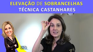 Elevação de sobrancelhas com cirurgia  Técnica Castanhares [upl. by Eustasius918]