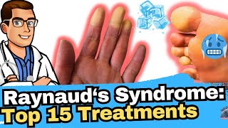 Raynauds Syndrome vs Phenomenon vs Disease Why Are My Toes Cold [upl. by Enajaras]