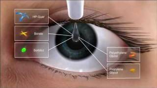 Alcon Dry Eye Video and Systane Ultra Action [upl. by Cameron]